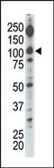 Diacylglycerol Kinase Iota antibody, MBS9209231, MyBioSource, Western Blot image 
