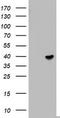 ETV7 antibody, TA802936, Origene, Western Blot image 