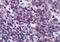 CCAAT Enhancer Binding Protein Beta antibody, orb88560, Biorbyt, Immunohistochemistry paraffin image 