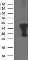 Tropomodulin 1 antibody, TA503146S, Origene, Western Blot image 