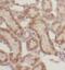 Sst2 antibody, FNab08253, FineTest, Immunohistochemistry paraffin image 