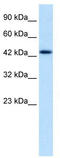 Homeobox protein DLX-2 antibody, TA329349, Origene, Western Blot image 
