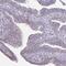 Dual Specificity Phosphatase 28 antibody, NBP1-94058, Novus Biologicals, Immunohistochemistry frozen image 