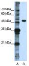 DEAD-Box Helicase 47 antibody, TA344044, Origene, Western Blot image 