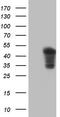 Troponin T2, Cardiac Type antibody, CF804541, Origene, Western Blot image 