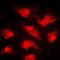 Forkhead Box O1 antibody, LS-C352211, Lifespan Biosciences, Immunofluorescence image 