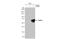 Glutamate Decarboxylase 2 antibody, GTX636493, GeneTex, Western Blot image 