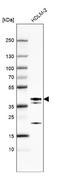 ETV7 antibody, NBP1-80694, Novus Biologicals, Western Blot image 
