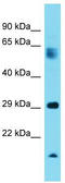 Proteasome Assembly Chaperone 2 antibody, TA331669, Origene, Western Blot image 