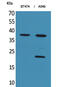 Interferon alpha-1 antibody, A33969, Boster Biological Technology, Western Blot image 