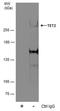 Methylcytosine dioxygenase TET2 antibody, PA5-78514, Invitrogen Antibodies, Immunoprecipitation image 