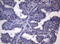 BAR antibody, M00835, Boster Biological Technology, Immunohistochemistry paraffin image 