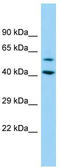 DEP Domain Containing 1B antibody, TA331864, Origene, Western Blot image 