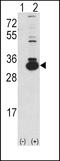 Ketohexokinase antibody, 62-633, ProSci, Western Blot image 