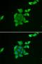 Tumor Suppressor 2, Mitochondrial Calcium Regulator antibody, orb247786, Biorbyt, Immunofluorescence image 