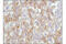 EGFR antibody, 71655S, Cell Signaling Technology, Immunohistochemistry paraffin image 