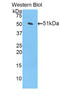Carnitine O-palmitoyltransferase 1, liver isoform antibody, LS-C301832, Lifespan Biosciences, Western Blot image 