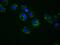 hsBG antibody, MA5-25103, Invitrogen Antibodies, Immunocytochemistry image 