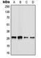 Basic Leucine Zipper ATF-Like Transcription Factor 2 antibody, MBS820366, MyBioSource, Western Blot image 