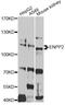 Ectonucleotide Pyrophosphatase/Phosphodiesterase 2 antibody, A2522, ABclonal Technology, Western Blot image 