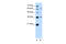 Zinc Finger And SCAN Domain Containing 12 antibody, 30-294, ProSci, Enzyme Linked Immunosorbent Assay image 