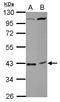 Chromosome 18 Open Reading Frame 54 antibody, LS-C155624, Lifespan Biosciences, Western Blot image 