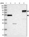 Actin Binding LIM Protein 1 antibody, NBP1-89304, Novus Biologicals, Western Blot image 