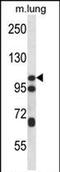 Catenin Delta 2 antibody, PA5-71725, Invitrogen Antibodies, Western Blot image 