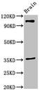 SLIT And NTRK Like Family Member 5 antibody, orb53011, Biorbyt, Western Blot image 