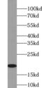 HILDA antibody, FNab09804, FineTest, Western Blot image 