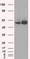 ATP Synthase F1 Subunit Beta antibody, TA500849, Origene, Western Blot image 