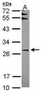 F-box only protein 6 antibody, GTX115813, GeneTex, Western Blot image 