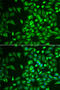 Lecithin retinol acyltransferase antibody, 22-377, ProSci, Immunofluorescence image 