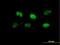 F-Box Protein 7 antibody, H00025793-B01P, Novus Biologicals, Immunocytochemistry image 