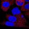 Lactate Dehydrogenase A antibody, MAB9216, Novus Biologicals, Immunofluorescence image 
