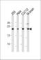 Ubiquitin Conjugating Enzyme E2 K antibody, PA5-35231, Invitrogen Antibodies, Western Blot image 