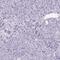 Cellular Repressor Of E1A Stimulated Genes 2 antibody, PA5-58302, Invitrogen Antibodies, Immunohistochemistry paraffin image 