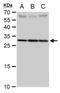 ANT2 antibody, GTX114252, GeneTex, Western Blot image 