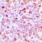 TATA-Box Binding Protein antibody, LS-C358352, Lifespan Biosciences, Immunohistochemistry frozen image 