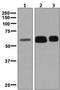 Glucosylceramidase Beta antibody, ab128879, Abcam, Western Blot image 