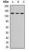 Aprataxin And PNKP Like Factor antibody, orb335909, Biorbyt, Western Blot image 