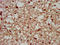 Serpin Family B Member 12 antibody, LS-C399571, Lifespan Biosciences, Immunohistochemistry paraffin image 