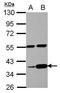 Leucine Zipper Protein 4 antibody, GTX105002, GeneTex, Western Blot image 