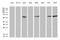 Serine/threonine-protein phosphatase 2B catalytic subunit beta isoform antibody, M07303, Boster Biological Technology, Western Blot image 