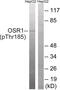Oxidative Stress Responsive Kinase 1 antibody, 79-859, ProSci, Western Blot image 