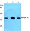 Protein Phosphatase 2 Catalytic Subunit Alpha antibody, A01893T301, Boster Biological Technology, Western Blot image 