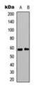 Estrogen Receptor 2 antibody, orb393279, Biorbyt, Western Blot image 