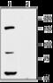 Potassium voltage-gated channel subfamily H member 8 antibody, GTX16687, GeneTex, Western Blot image 