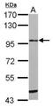 Suppression Of Tumorigenicity 14 antibody, NBP2-42884, Novus Biologicals, Western Blot image 