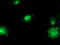 Catenin Beta 1 antibody, LS-C172670, Lifespan Biosciences, Immunofluorescence image 